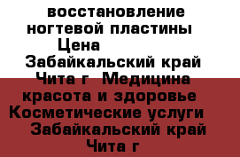 восстановление ногтевой пластины › Цена ­ 600-700 - Забайкальский край, Чита г. Медицина, красота и здоровье » Косметические услуги   . Забайкальский край,Чита г.